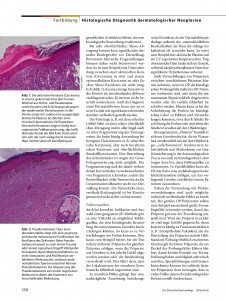 https://www.dermatohistologie.bayern/wp-content/uploads/2016/06/file-page3-226x300.jpg